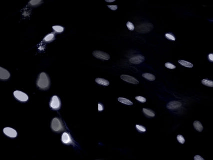 Close-up of a textured black surface with white oval patterns